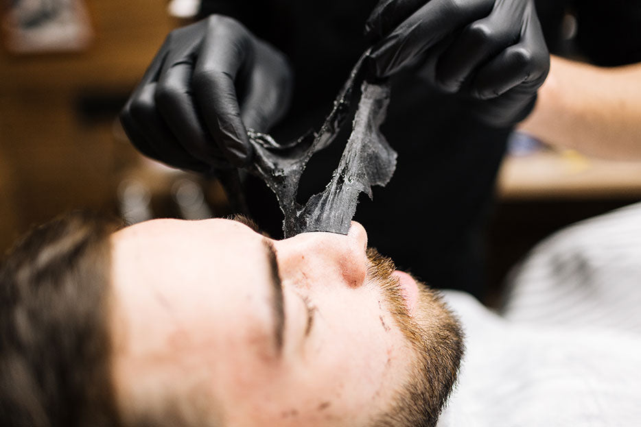 Todo sobre los puntos negros