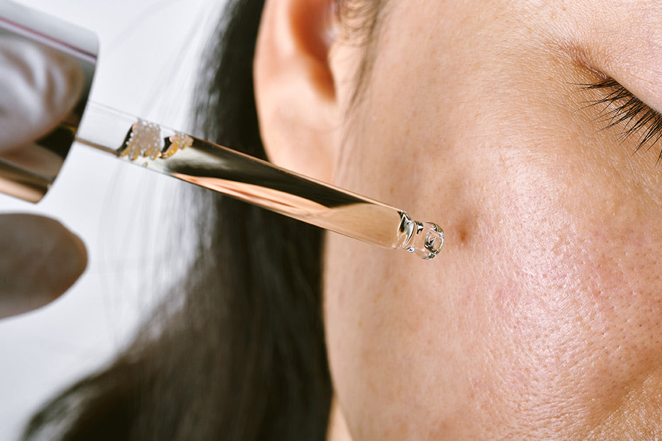 Despídete del acné con el ácido salicílico