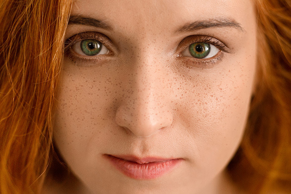 ¿Manchas en la cara? No más, aprende a lidiar con ellas y diles adiós.