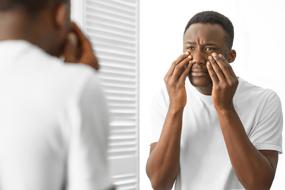 Dile adiós a las ojeras